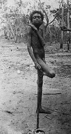 Young Australian Native Posing on One Leg