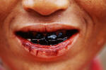 A Palung Hill tribeswoman teeth have turned black from chewing on betel nuts.
