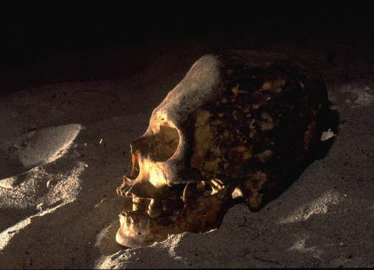 Adult's skull modified by the ritual deformation